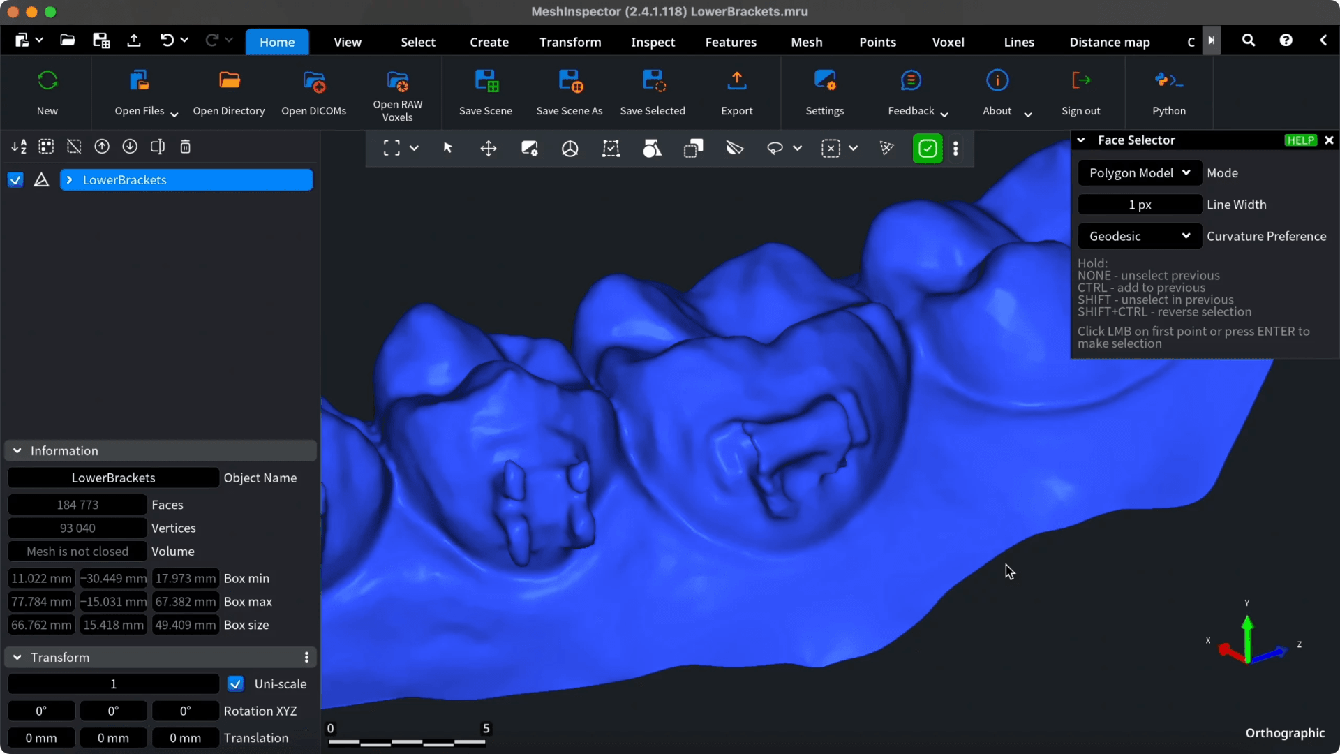 Face Selector controls beside a dental mesh with brackets.
