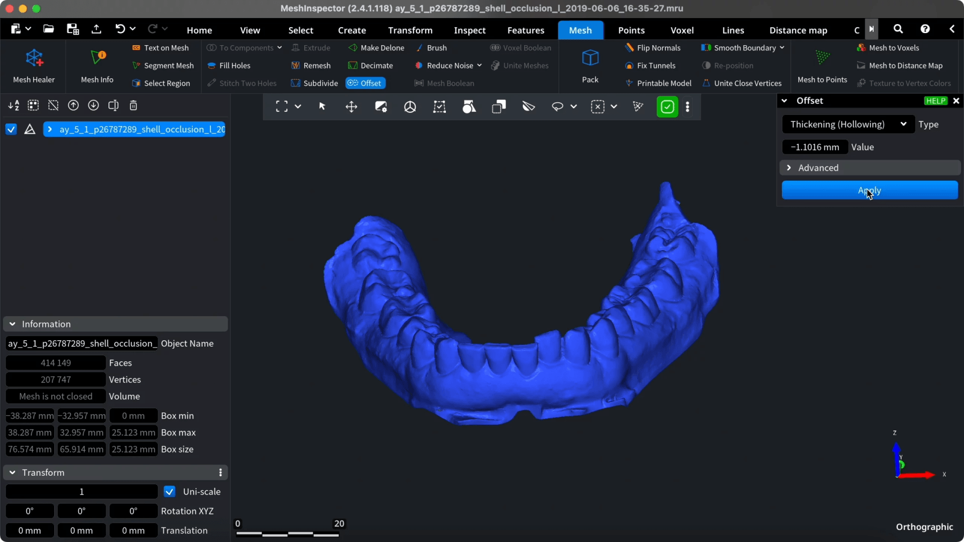 Offset controls applied to a dental arch model.