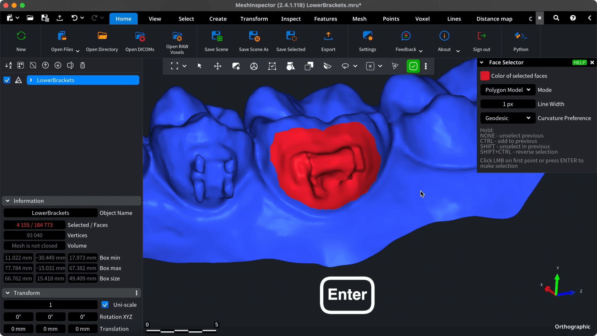 Bracket region selected in red on the dental mesh.