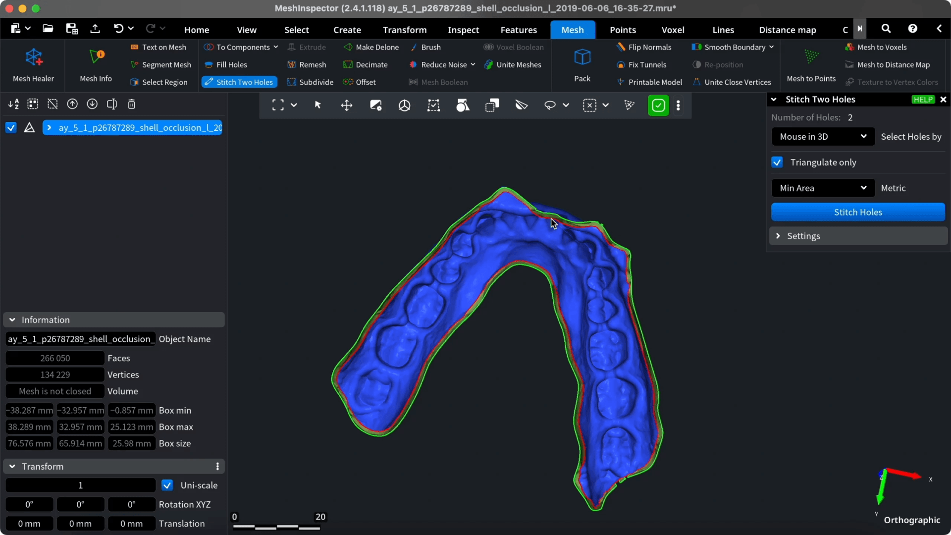 Boundary edges highlighted around the base of a dental arch.