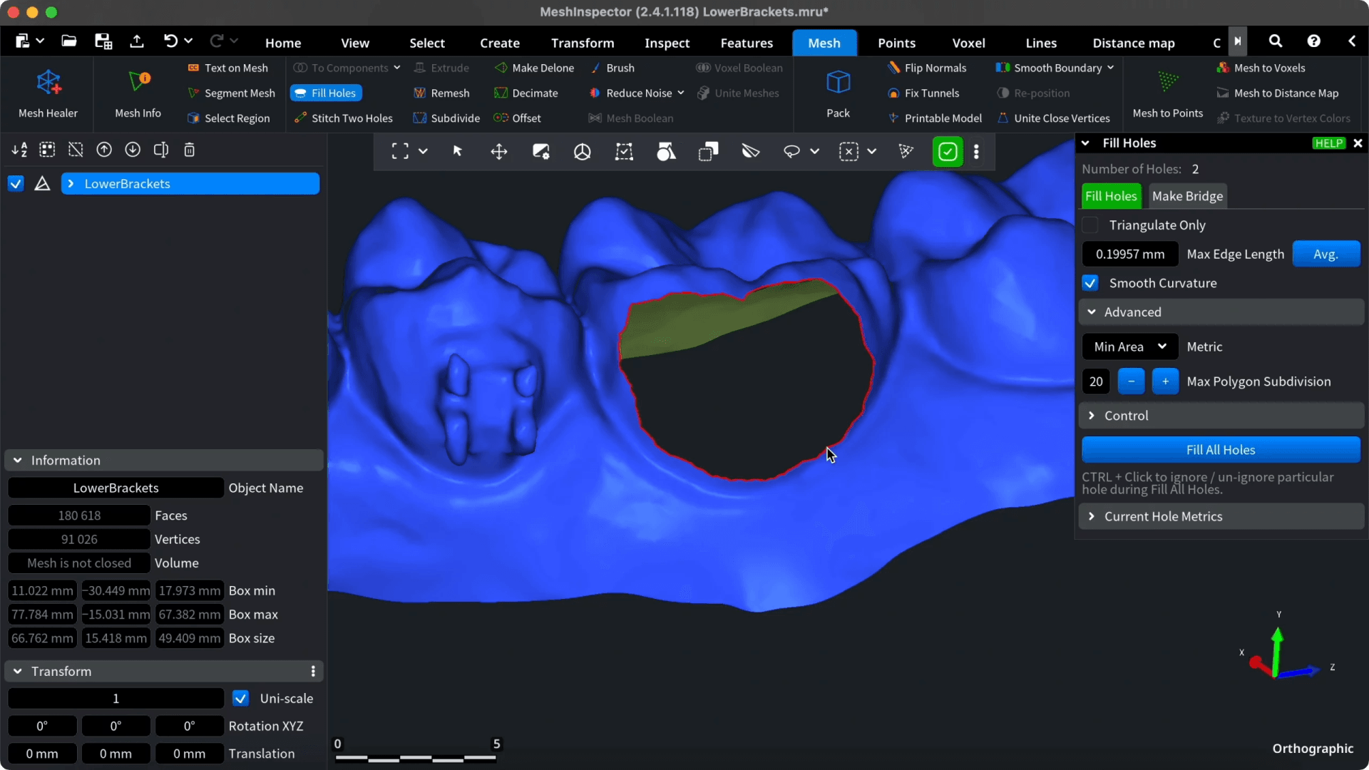 Fill Holes controls beside the opening in the dental mesh.