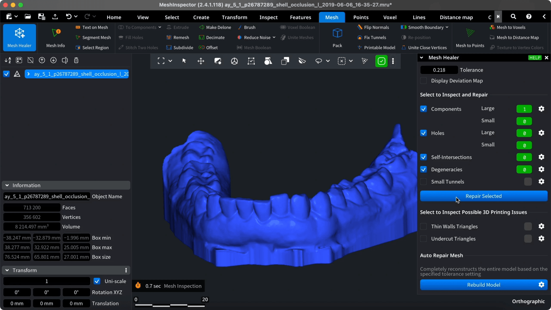 Mesh Healer results beside the dental arch model.