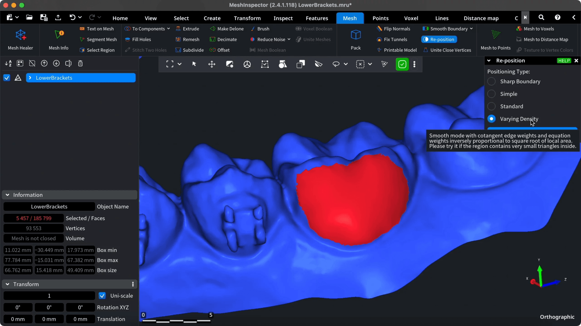 Filled region selected for refinement on the dental mesh.