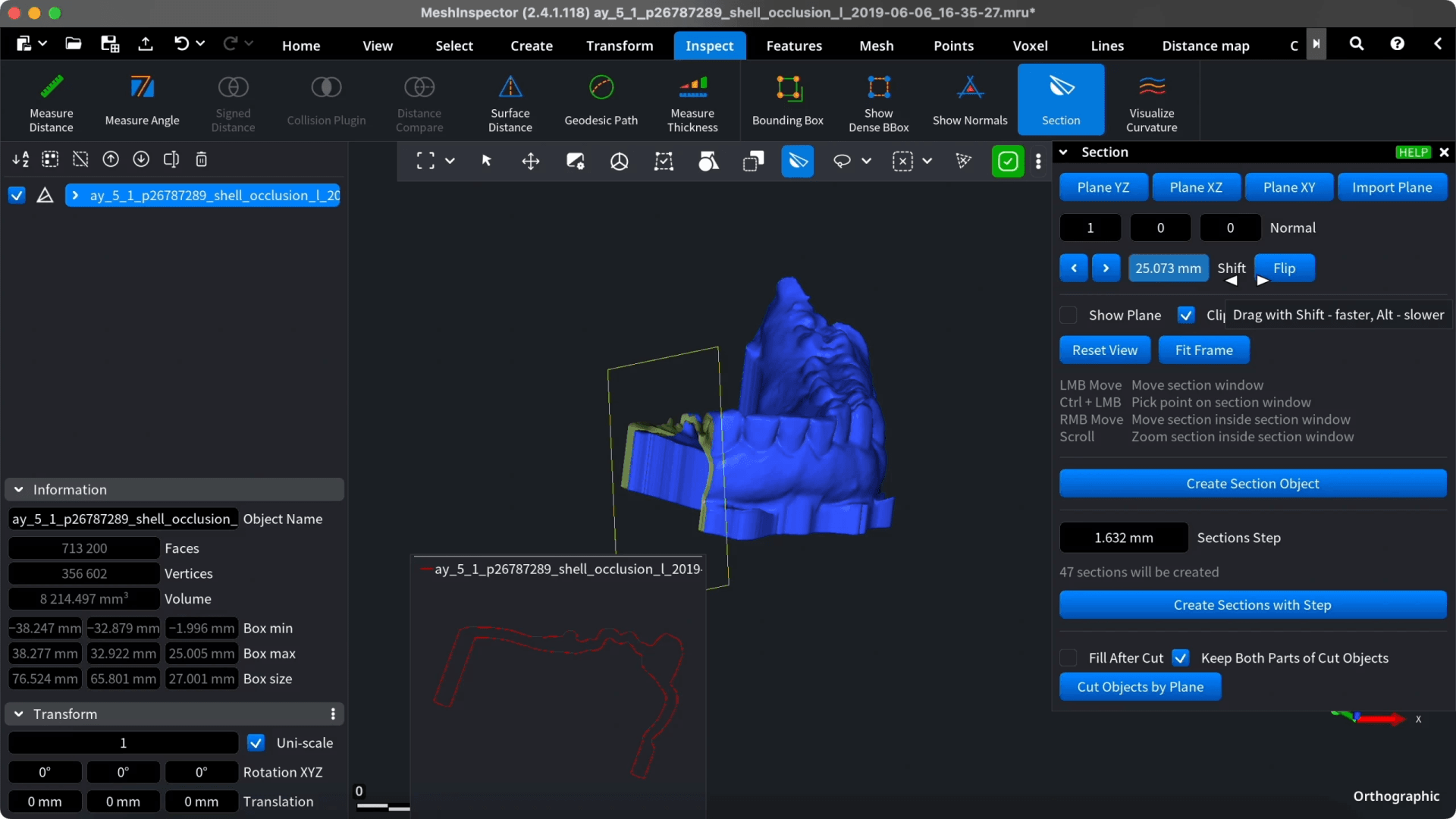 Measurement and inspection controls around the dental model.