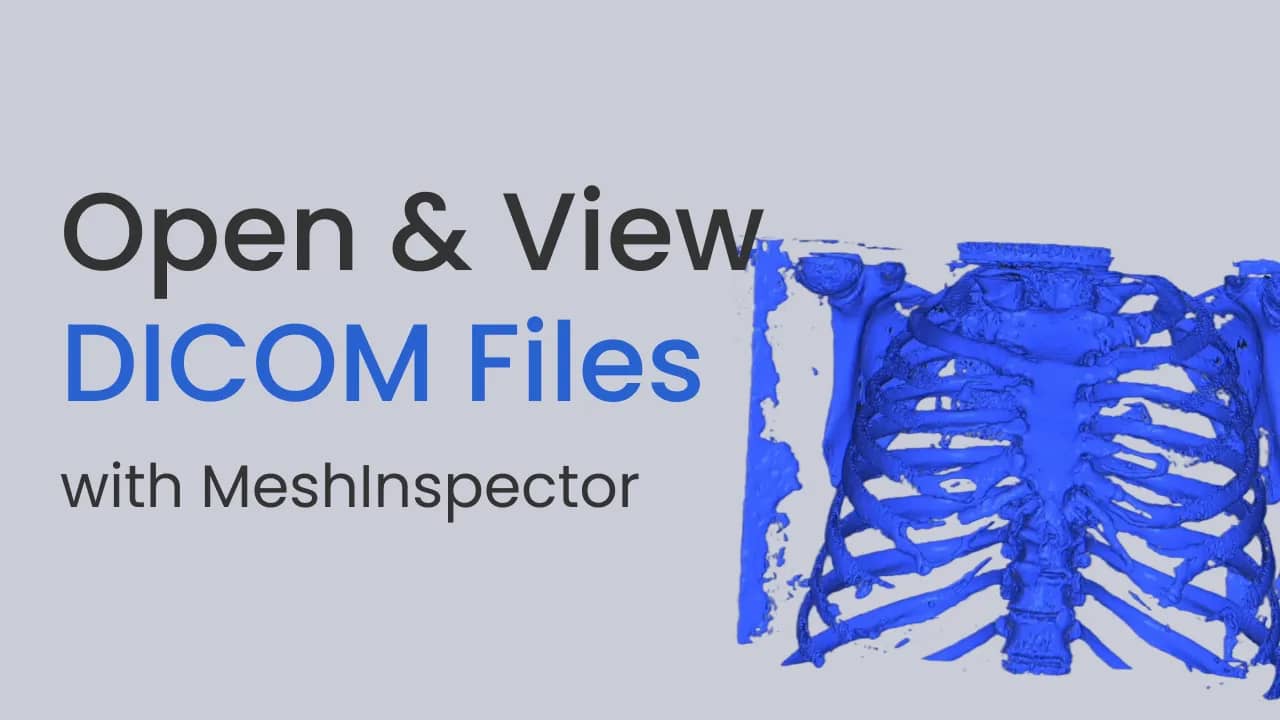 Illustration of opening and viewing DICOM files.