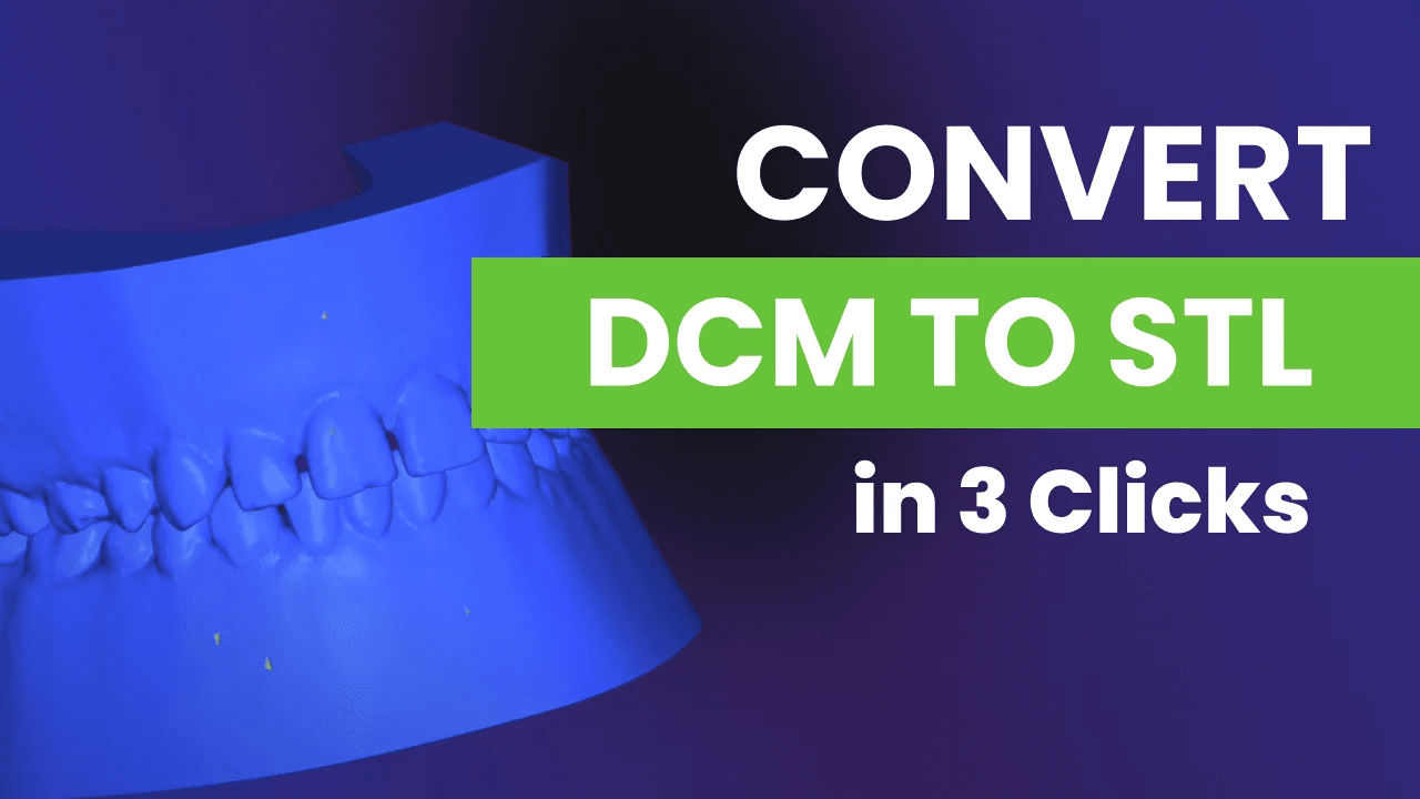 DCM to STL conversion graphic.