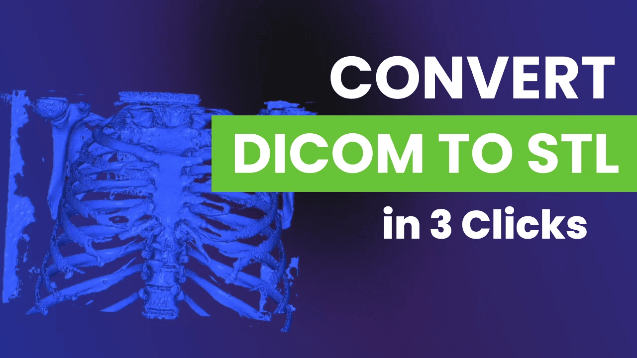 DICOM to STL conversion graphic.