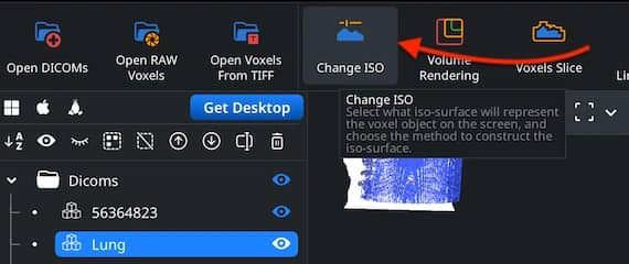 Change ISO command in the CT toolbar.