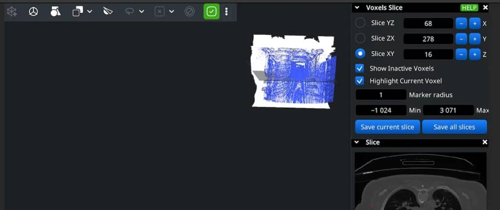 Voxel slice views and position controls beside the reconstructed volume.