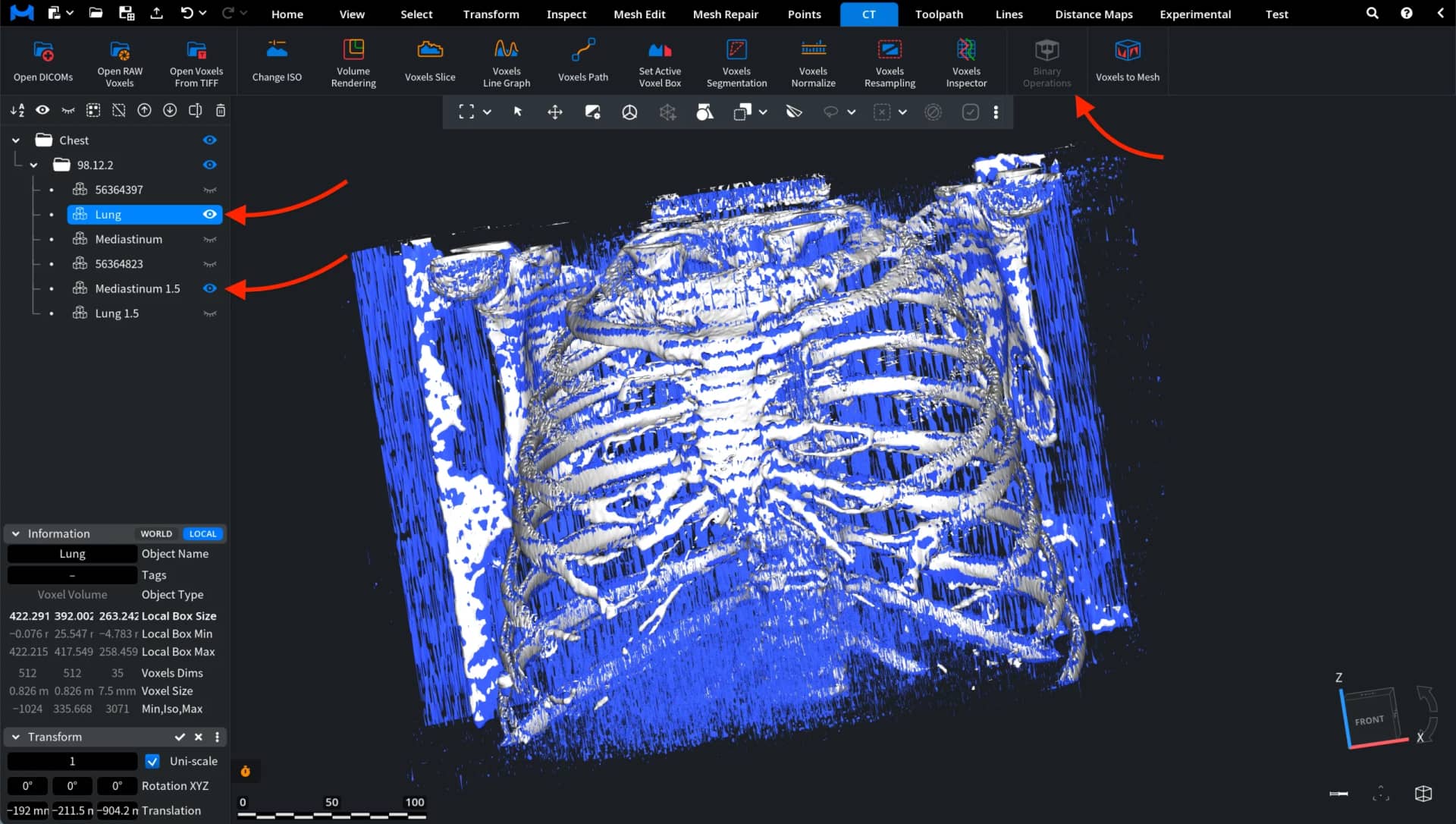 Binary Operations: Two Voxel Volumes