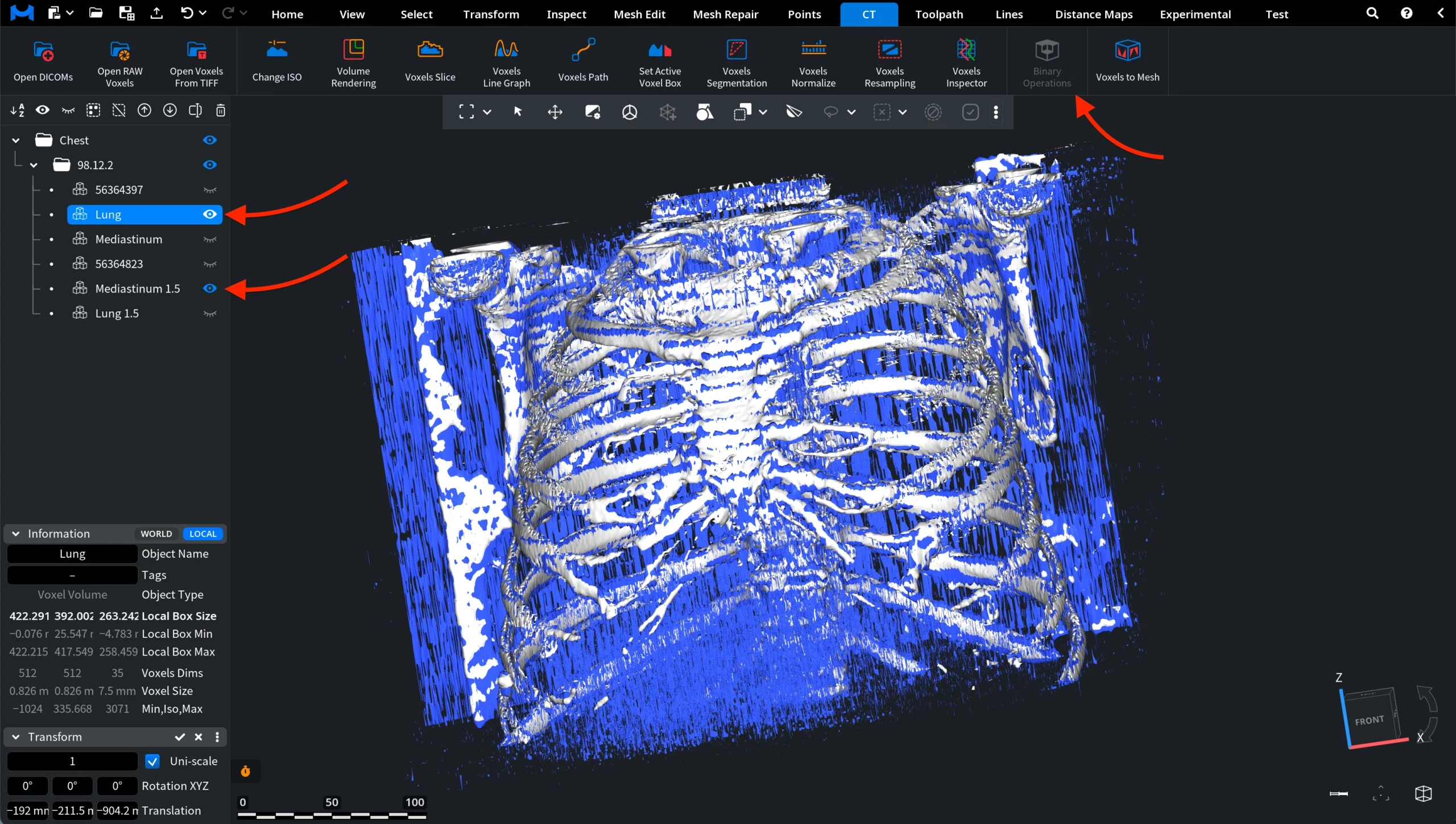 Binary Operations: Two Voxel Volumes