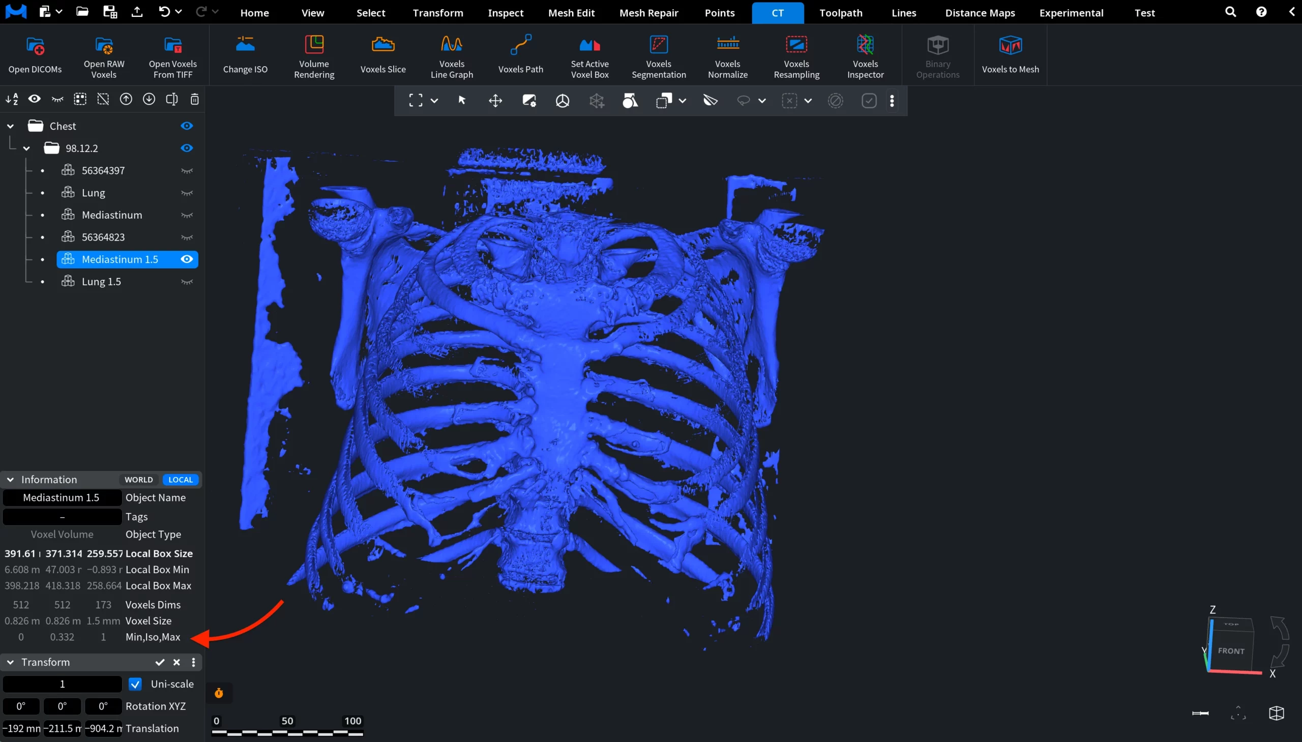 Voxels Normalize: After