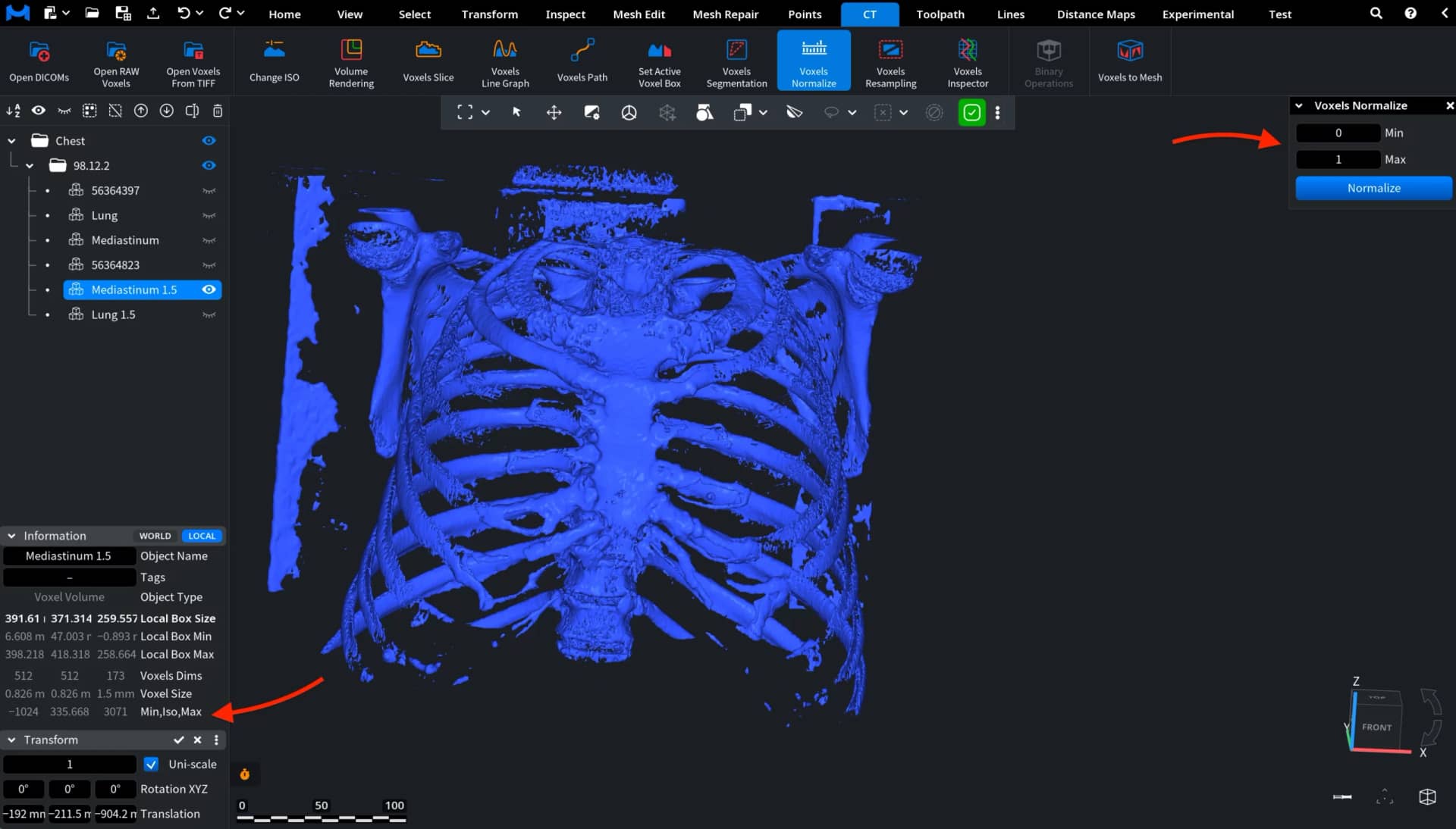 Voxels Normalize: Before