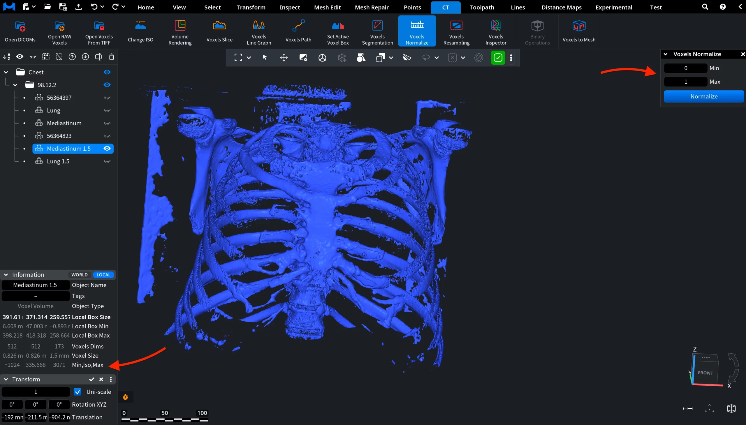 Voxels Normalize: Before