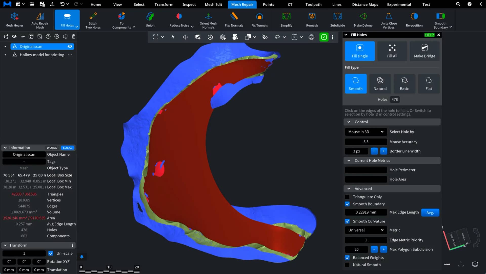 Dental mesh with a highlighted region and hole-repair controls.