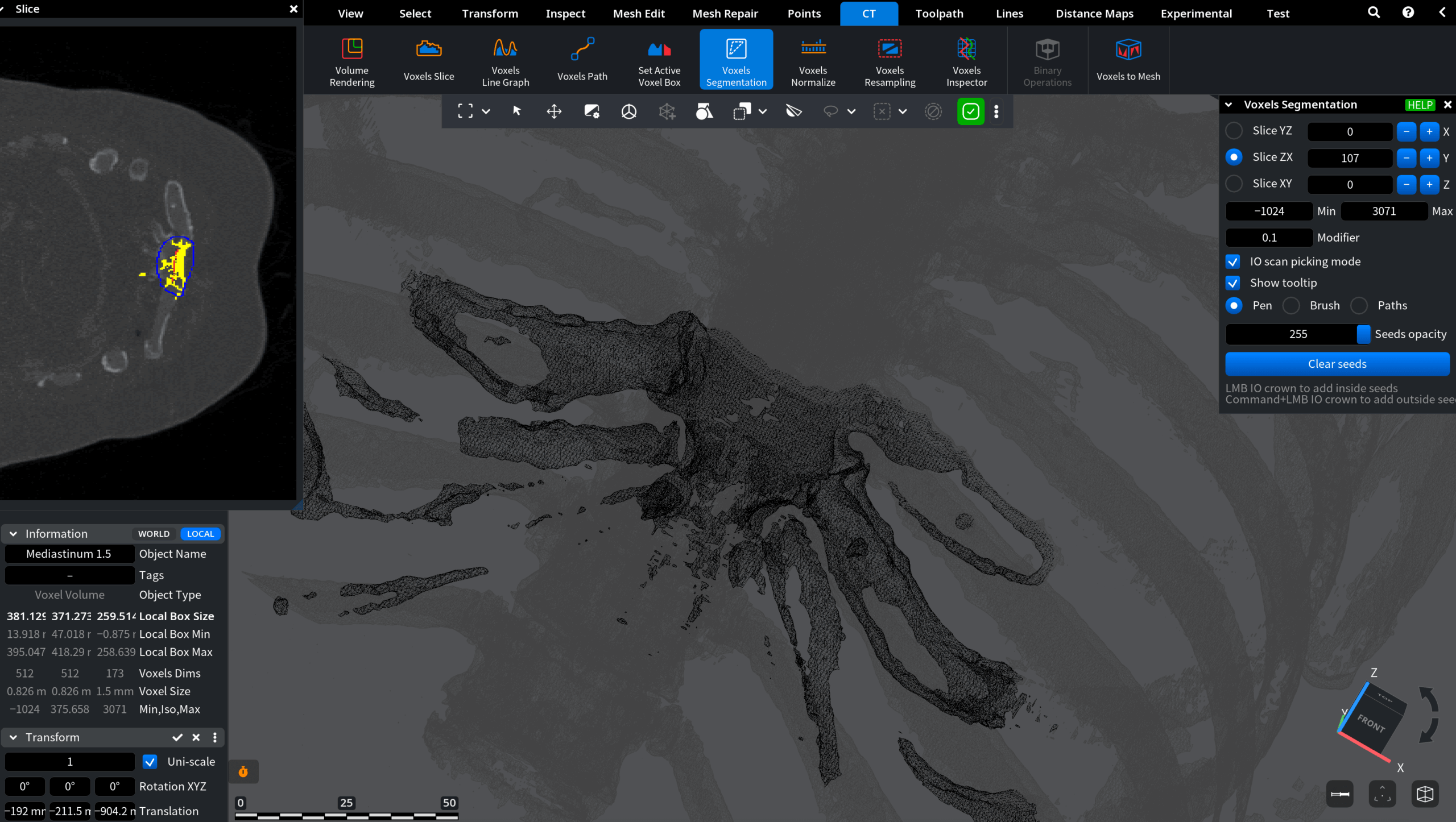 Voxels Segmentation: After Clicking Enter 