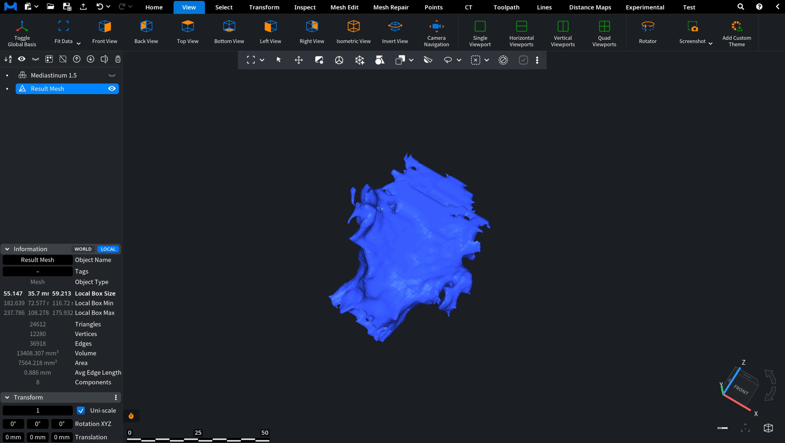 Voxels Segmentation: Example 2. Result