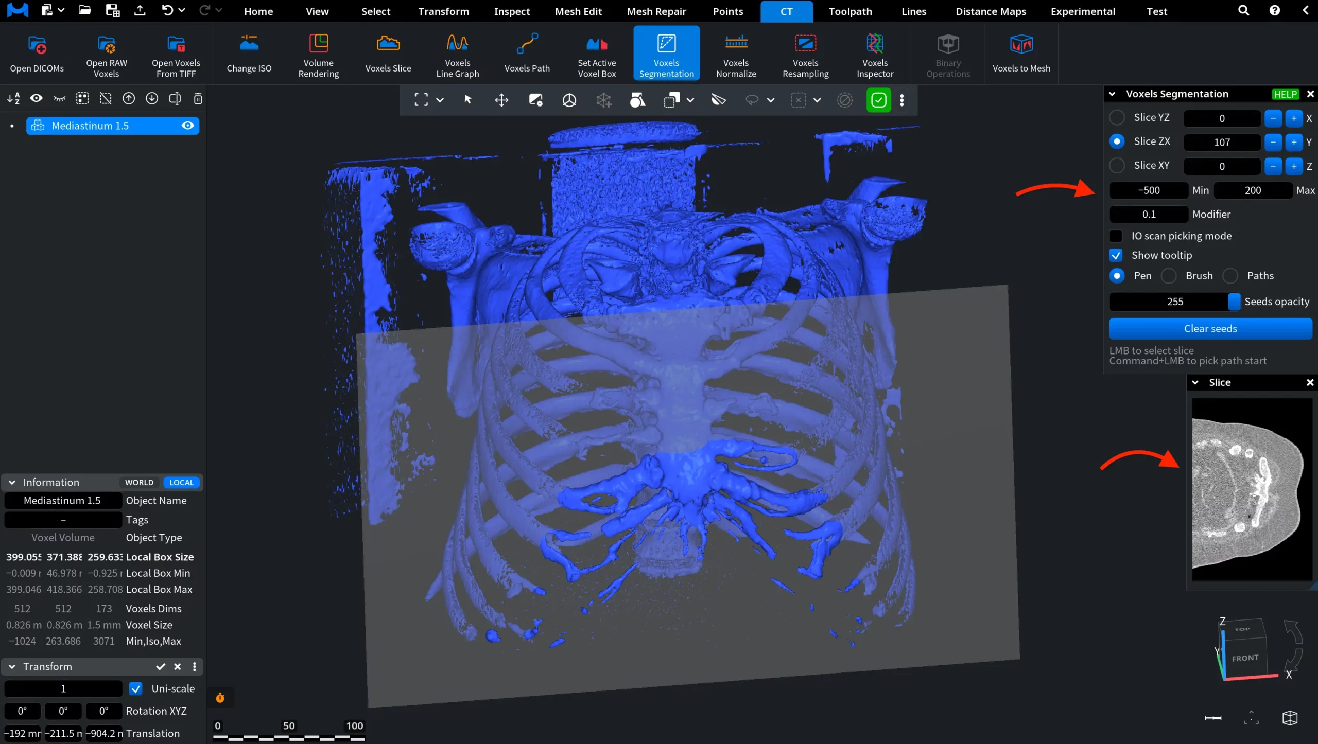 Voxels Segmentation: Narrow Range