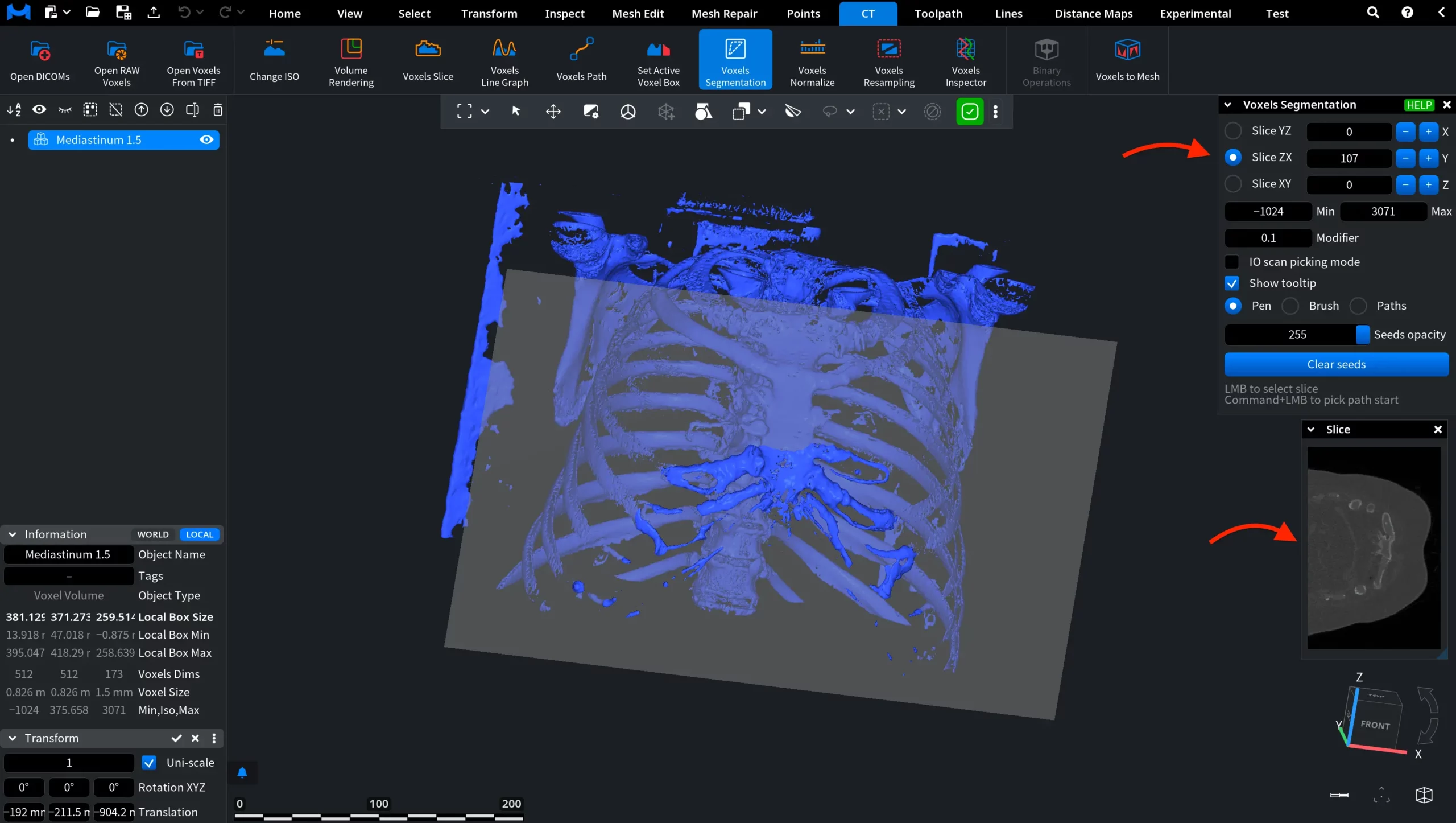Voxels Segmentation Tool: Panel Overview