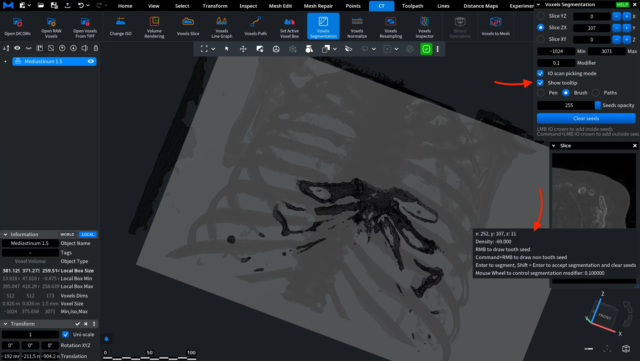 Voxels Segmentation: Show Toolip