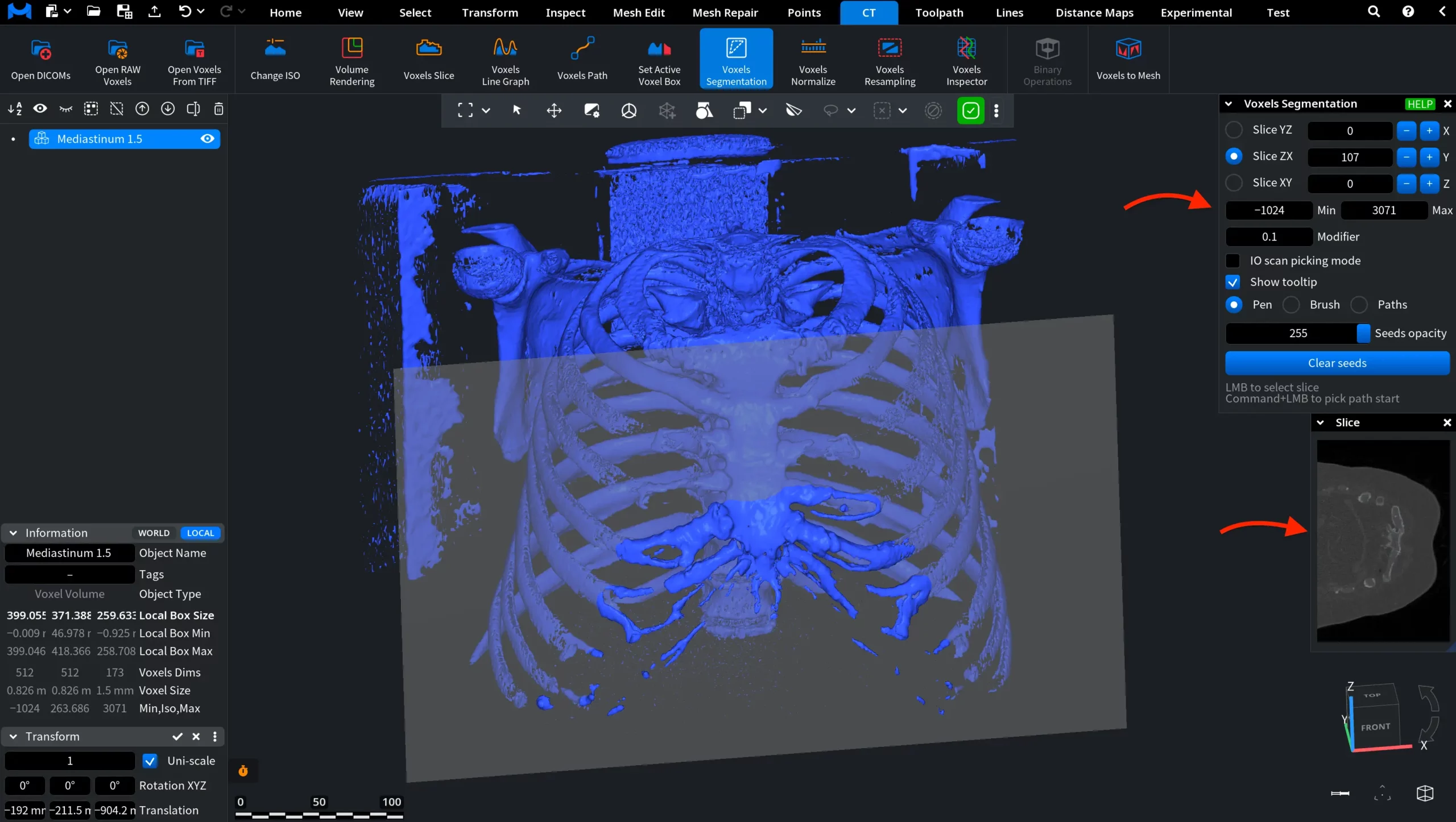 Voxels Segmentation: Wide Range